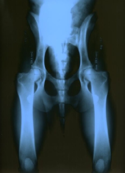 CH. Baslak des Legendes de Retz