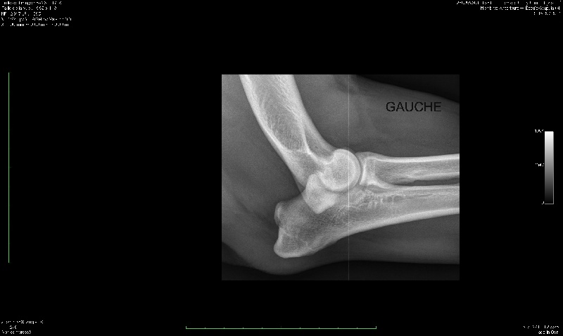 Harmonieuse douceur Red Dog Demars