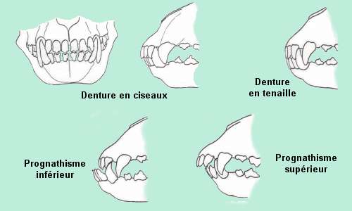 dentition