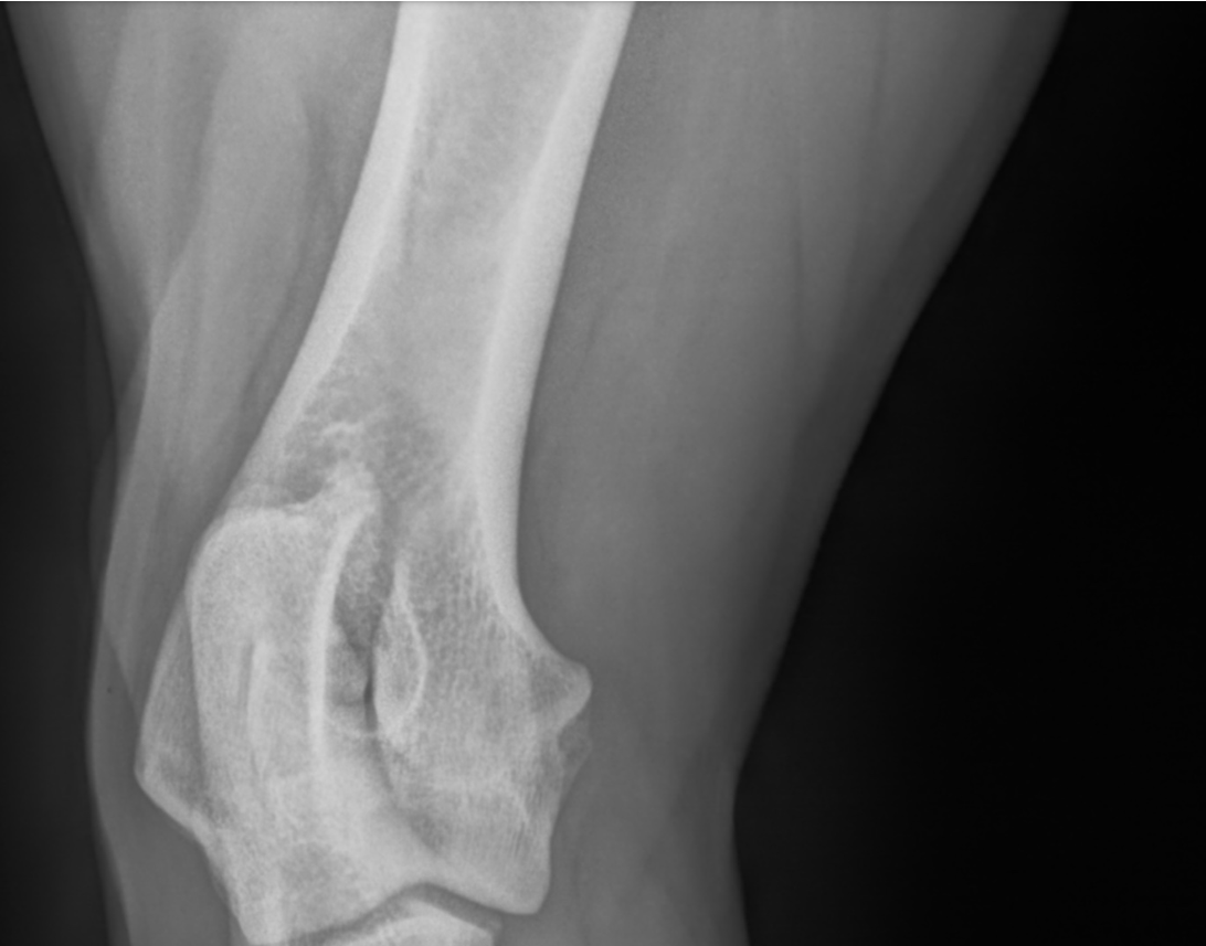 UNA VEIANA des légendes de goliath