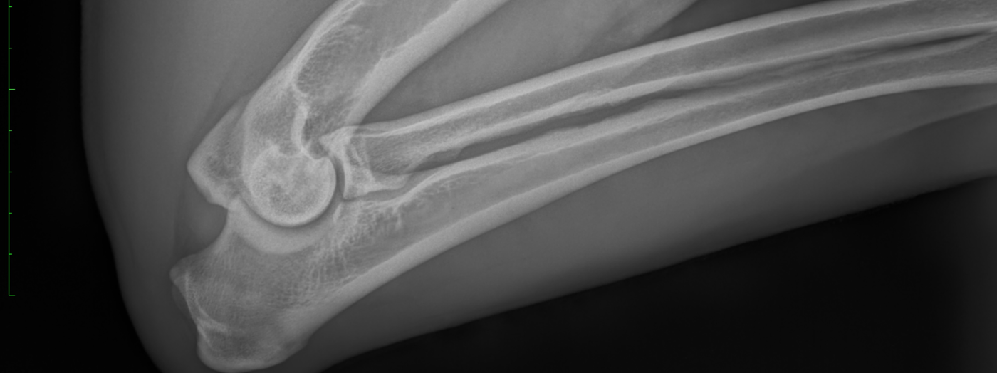 UNA VEIANA des légendes de goliath